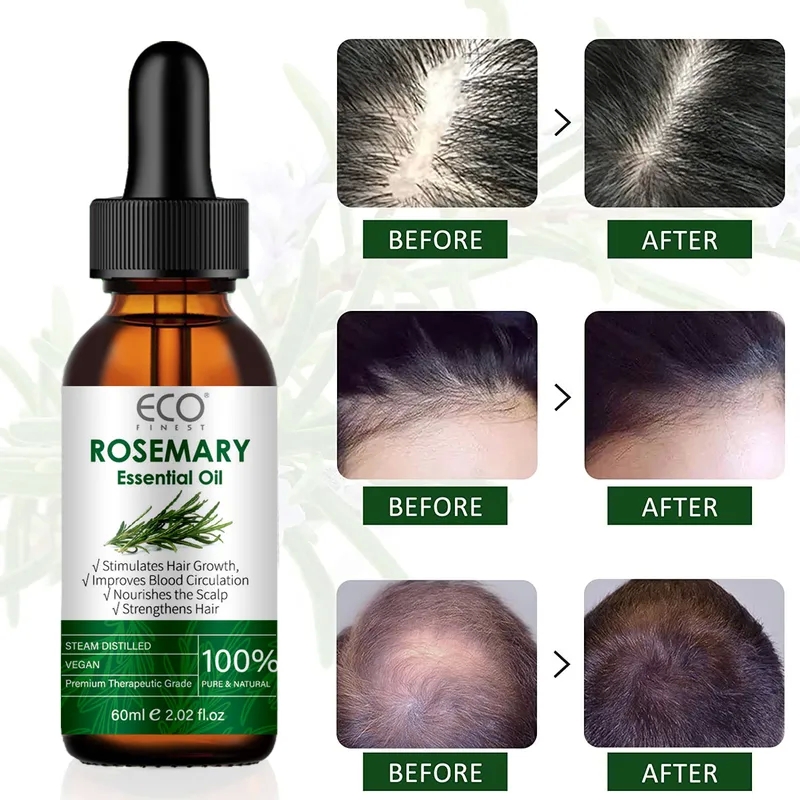health beauty 58 Luxury Rosemary beauty queen health centre guelph reviews Scalp Oil for Dry Frizz-Free Hair: Timeless Beauty with Refined Craftsmanship laleham health and beauty pr4 3ja