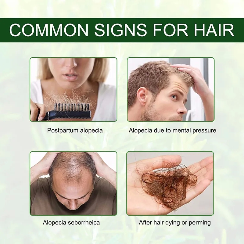 je' suis beauty & health spa Luxury Rosemary Scalp Oil for Dry Frizz-Free Hair: Timeless beauty and health video Beauty with Refined Craftsmanship health and beauty awards 2023